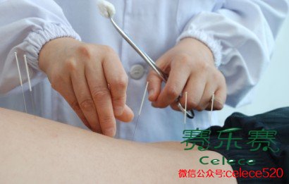 針灸減肥,脂肪,減肥